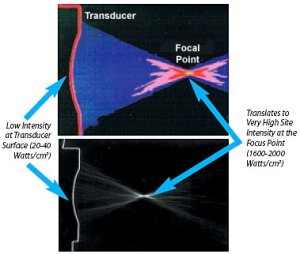 Reproduced from European Journal of Ultrasound 9, 19-29, 1999