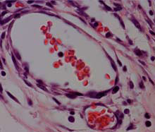 A cross-section of the new tissue with functional blood vessels (the hollow ovals) containing red blood cells