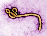 Transmission electron micrograph of Ebola virus. Courtesy of the Centers for Disease Control and Prevention