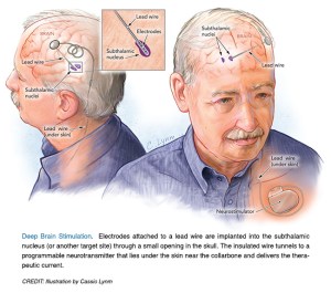 Lasker_2014_illustration_clinical_1