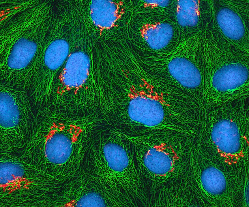 Download original file2400 × 1999 px jpg View in browser You can attribute the author Show me how Multiphoton fluorescence image of cultured HeLa cells with a fluorescent protein targeted to the Golgi apparatus (orange), microtubules (green) and counterstained for DNA (cyan). Nikon RTS2000MP custom laser scanning microscope. National Institutes of Health (NIH). 