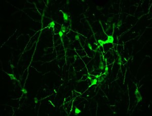 Yates lab neurotransmitter photo