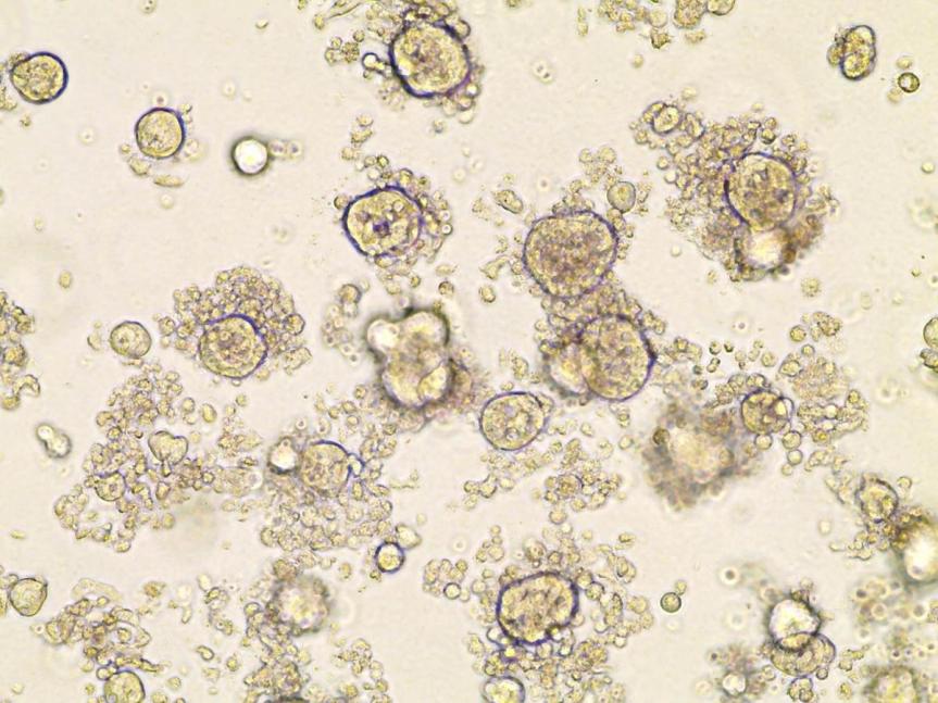 Colorectal cancer organoids being grown in the lab. Credit: Hayley E. Francies, Wellcome Trust Sanger Institute