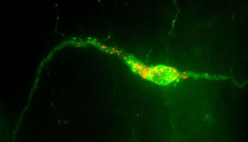 A GnRH neuron present in the hypothalamus.