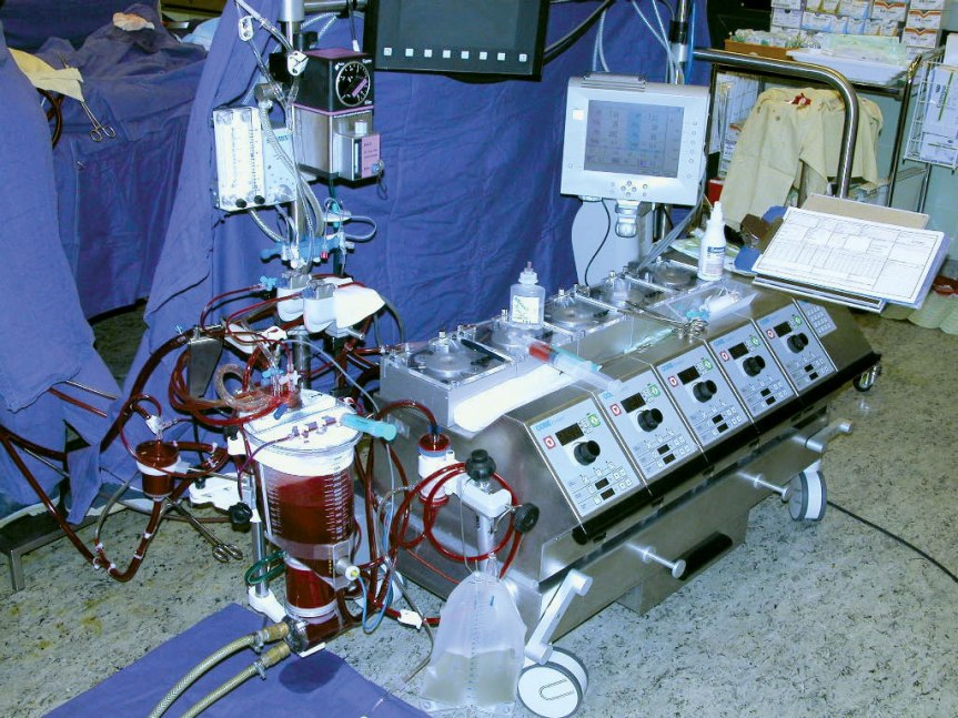Heart Lung Machine